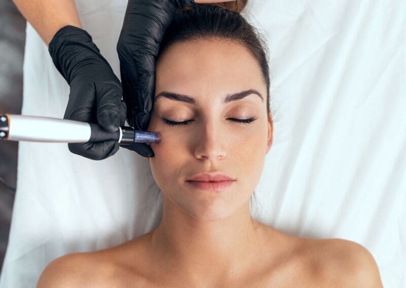Dermapen eye lifting