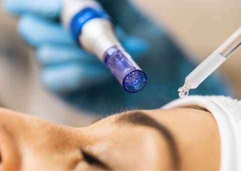 Dermapen facial