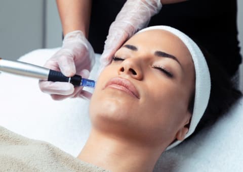 rejuvenecimiento facial malaga